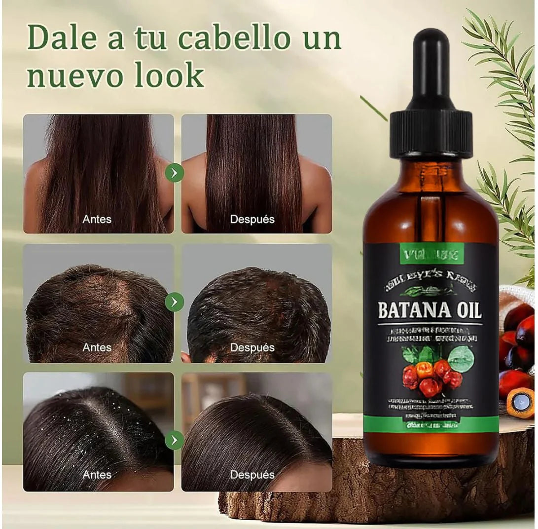 ACEITE DE BATANA OIL